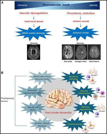 Jean Daniel Lelièvre on LinkedIn: The immunology of stroke and dementia | NeuroImmunology | Scoop.it