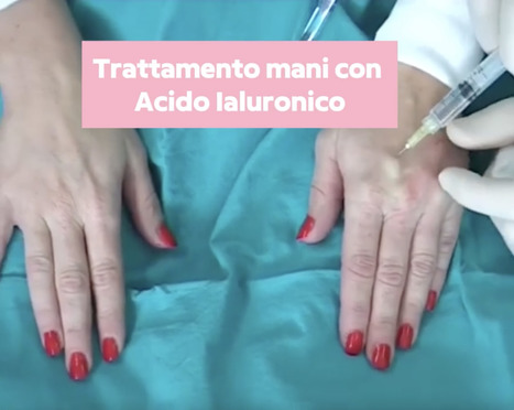 Ringiovanimento mani Roma - Elimina macchie e rughe | Dr. Luca Piovano | Medicina Estetica News | Scoop.it