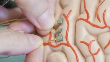 New two-way brain-computer interface has returned motion AND sensation to a paralysed test patient | Brain Computer Interfaces & connected medical devices | Scoop.it