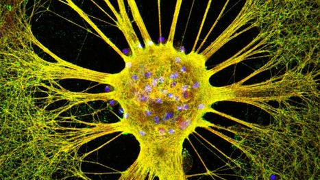 R&eacute;sistance aux antid&eacute;presseurs : des neurones capables de s&rsquo;autor&eacute;guler | Sant&eacute;, m&eacute;decine, sexualit&eacute; et culture g&eacute;n&eacute;rale | Scoop.it