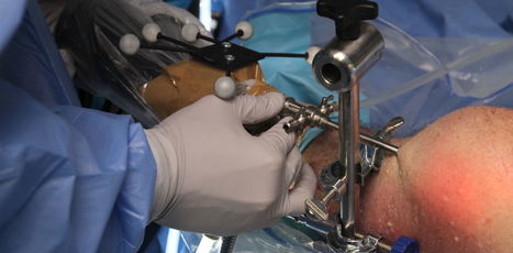 Surgeons admit to mistakes in surgery and would use robots if they reduced the risks | Simulation in Health Sciences Education | Scoop.it
