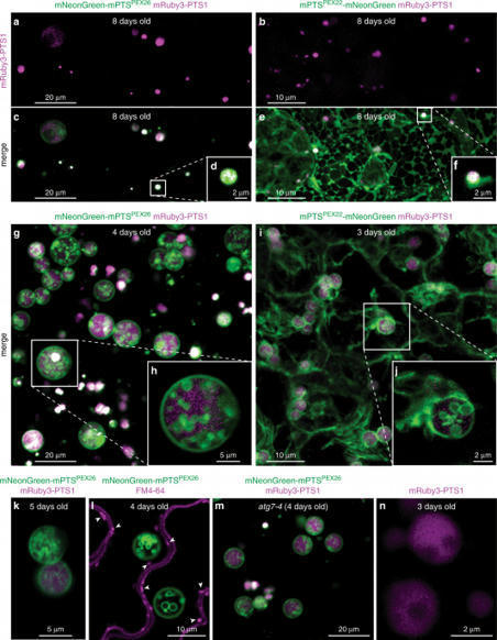 Coup de cœur - Les peroxysomes forment des vésicules intraluminales jouant un rôle dans le catabolisme des acides gras et la compartimentation des protéines | Life Sciences Université Paris-Saclay | Scoop.it