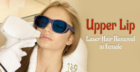 laser hair removal upper lip