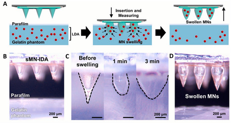 Swellable Microneedles in Drug Delivery and Diagnostics | Intra-Dermal drug delivery: Opportunities and Challenges? | Scoop.it