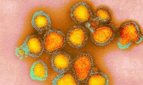 CDC names EIGHT diseases which could spark pandemic | Virus World | Scoop.it
