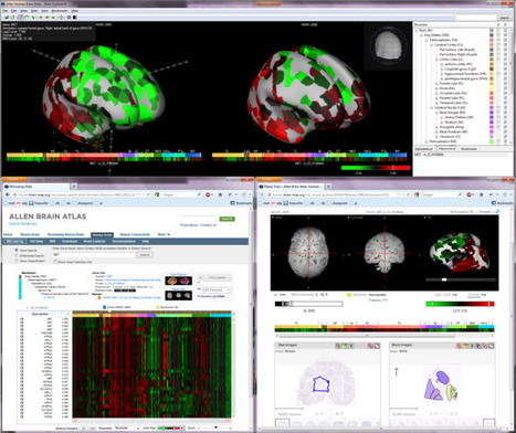 The Human Brain Online: An Open Resource for Advancing Brain Research | Science News | Scoop.it