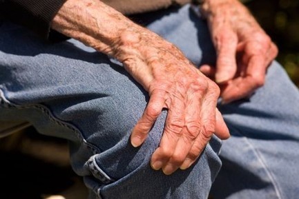 Vers un traitement innovant de l'arthrose ? - News Santé - Doctissimo | L'arthrose | Scoop.it
