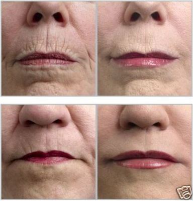 More Stem Cells..Anti-aging Discovery ! Anti Aging Treatment ..  =>Click Here <= & leave a Comment on Looking Younger. | Adult Stem Cells Repair Body | Scoop.it