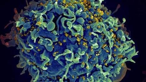 La progression du VIH freinée dans les cellules réservoirs  | sida | Scoop.it