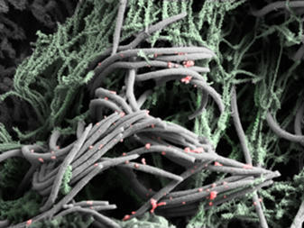 Stanford Medicine scientists pinpoint COVID-19 virus’s entry and exit ports inside our noses | News Center | Stanford Medicine | Mucosal Immunity | Scoop.it