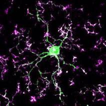 University of Rochester : "The Brain’s Gardeners, immune cells ‘prune’ connections between neurons | Ce monde à inventer ! | Scoop.it
