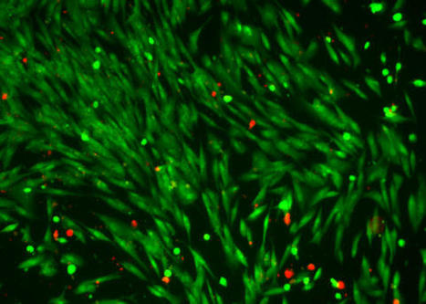 On the spot drug delivery with light-controlled organic microswimmers | Amazing Science | Scoop.it