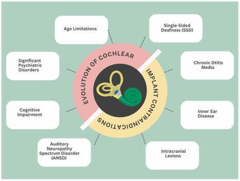 The Chronological Evolution of Cochlear Implant Contraindications: A Comprehensive Review | Revue de presse Implant Cochléaire | Scoop.it