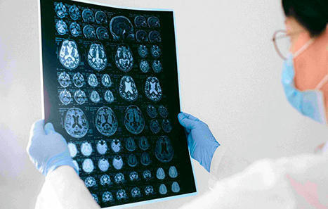 8 aspectos a considerar sobre la enfermedad de Alzheimer | Alzheimer y más (Boletín nº 77) | Scoop.it