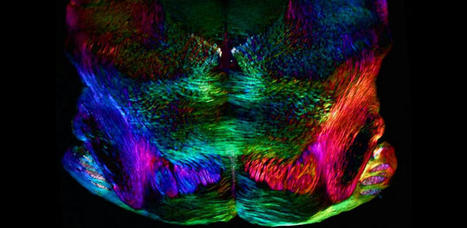 Scientists reverse age-related memory loss in mice | Amazing Science | Scoop.it