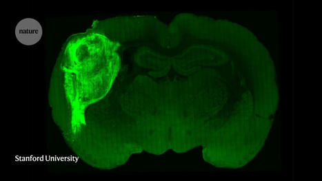 Human brain cells implanted in rats prompt excitement — and concern - Nature | Animal Models - GEG Tech top picks | Scoop.it