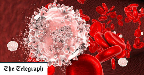 Childhood Leukaemia Likely Driven by Common Infections Such as Flu | Hematology | Scoop.it