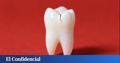 Inventan un gel que repara los dientes dañados por la edad en solo días | Santiago Sanz Lastra | Scoop.it