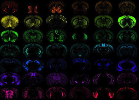 Scientists Design Gene Delivery Systems for Cells in the Brain and Spinal Cord | Virus World | Scoop.it