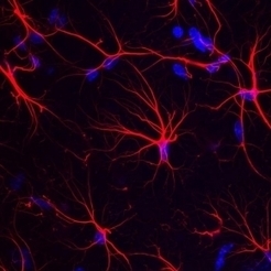 Alzheimer : un acide aminé pour aider à restaurer la mémoire ? | Life Sciences Université Paris-Saclay | Scoop.it