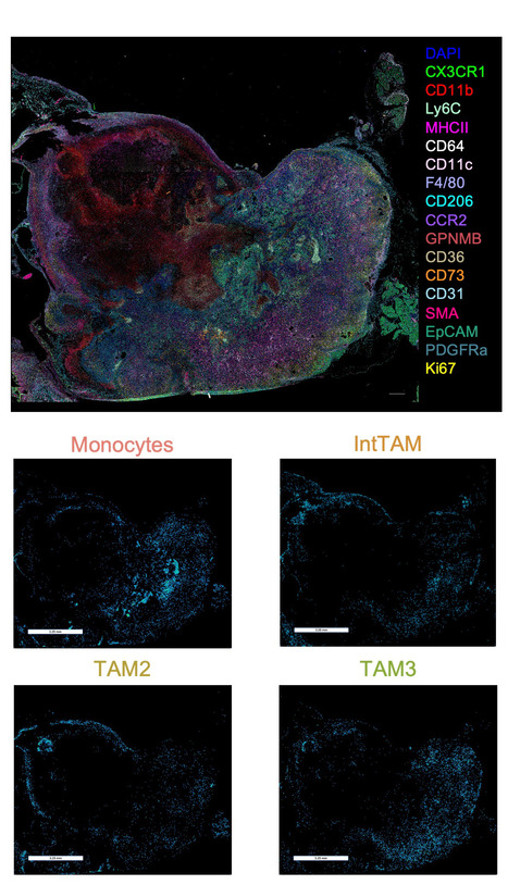 Une analyse dans le temps et l’espace de la transition des monocytes en macrophages tumoraux | Life Sciences Université Paris-Saclay | Scoop.it
