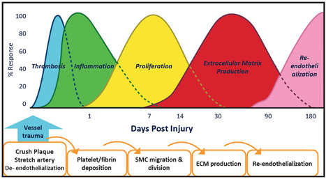 Combining a Drug-Coated Balloon and a Bare-Metal Stent: The REsponse Adapted Combination Therapy (REACT) Strategy | Critical Limb-Threatening Ischemia (CLTI) | Scoop.it