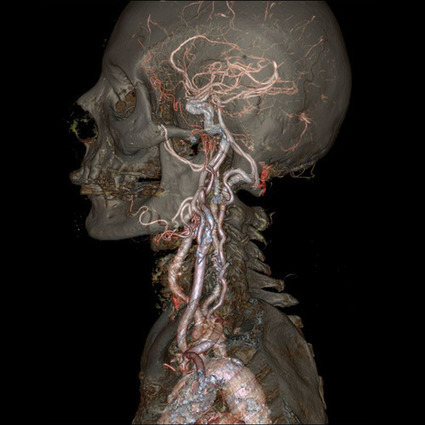 Gorgeous and creepy GIFs of guts, brains and bones from GE’s new body scanner | 21st Century Innovative Technologies and Developments as also discoveries, curiosity ( insolite)... | Scoop.it