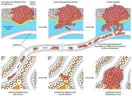 Identify Circulating Tumor Cells | just light information | from Flow Cytometry to Cytomics | Scoop.it