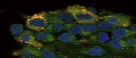 Joint cell finding gives clues for improved treatment of rheumatoid arthritis | Rheumatology-Rhumatologie | Scoop.it