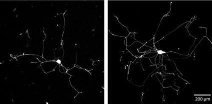 Making axons branch and grow to help nerve regeneration after injury | 21st Century Innovative Technologies and Developments as also discoveries, curiosity ( insolite)... | Scoop.it