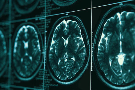 The Drake IPV Study | Trauma Care | Scoop.it