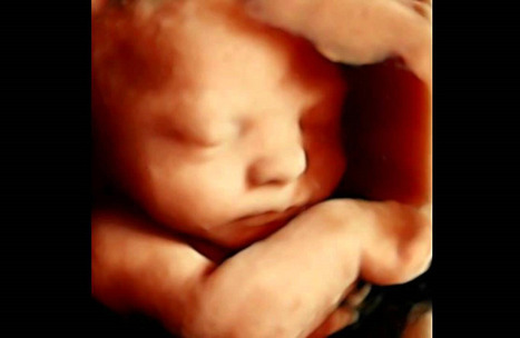 Texas Town Becomes 84th City in America to Ban Abortions | Industry 411 - Waste Management | Scoop.it