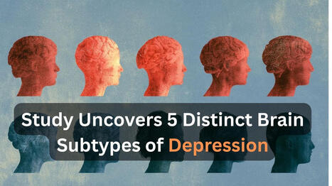 Five Brain Profiles of Depression Identified | Grief & Bereavement Counseling | Scoop.it