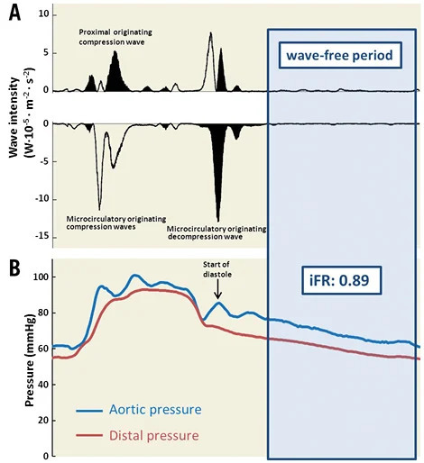 Accuracy of Instantaneous Wave-free Ratio and F...