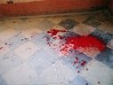 Un journaliste spécialisé dans les affaires sensibles, victime d'une violente agression | Lettonie | Journalisme & déontologie | Scoop.it