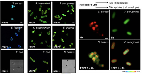 Lifetime chemical sensor arrays of organic fluorophores for bacterial fingerprinting | Ncm | RMH | Scoop.it