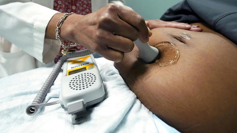 Soaring maternal mortality figures expose deplorable state of women&rsquo;s health care in America - WSWS.org | Operation Oya | Scoop.it