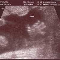 Protecting the digital identity of my unborn child | The 21st Century | Scoop.it
