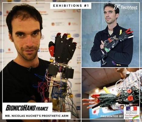 Le projet breton de prothèse bionique imprimée en 3D en finale du Google Impact Challenge | Science & Transhumanisme | Scoop.it