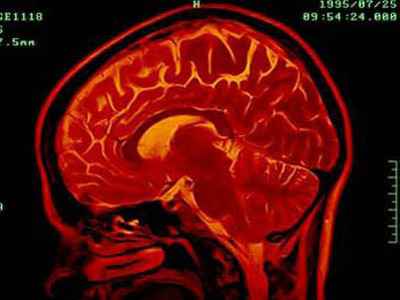 The Neuroscience Behind Why We Screw Up Under Pressure | TheBottomlineNow | Scoop.it