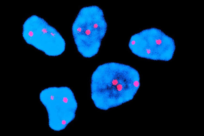 Injection halves risk of chromosome error common in older human eggs | The Health Report | Scoop.it