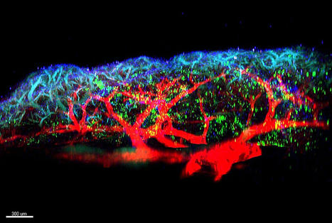 Respiratory allergies: Newly discovered molecule plays a major role in triggering inflammation | Allergy (and clinical immunology) | Scoop.it