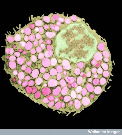 Mast cell full of histamine granules (pink) | Immunology for University Students | Scoop.it