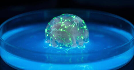 Cient&iacute;ficos de Johns Hopkins cultivan 30 'mini-cerebros' de pacientes para predecir la respuesta a f&aacute;rmacos contra el Alzheimer | Mi Caj&oacute;n de Ideas | Scoop.it