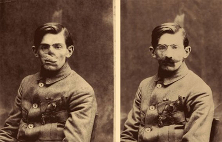 Les « gueules cassées » - Les visages défigurés de la Grande Guerre - Herodote.net | Autour du Centenaire 14-18 | Scoop.it