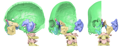 Reconstruction 3D des sinus paranasaux et des cellules mastoïdiennes du roi de France Henri IV (1610) | Life Sciences Université Paris-Saclay | Scoop.it