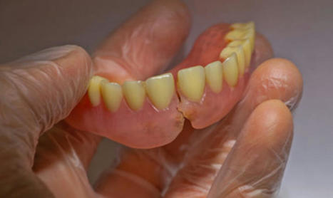 Why Your Denture Gets Broken | My Affordable Dentist Near Me | Scoop.it
