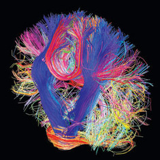 A Countdown to a Digital Simulation of Every Last Neuron in the Human Brain: Scientific American | Longevity science | Scoop.it