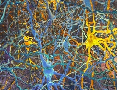 Santé Log : "Neurosciences | Première taxonomie de toutes les cellules du cerveau | Ce monde à inventer ! | Scoop.it