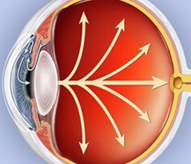 Detectan posibles biomarcadores del glaucoma que podrían permitir diagnosticar en sus estadios iniciales | Salud Visual 2.0 | Scoop.it